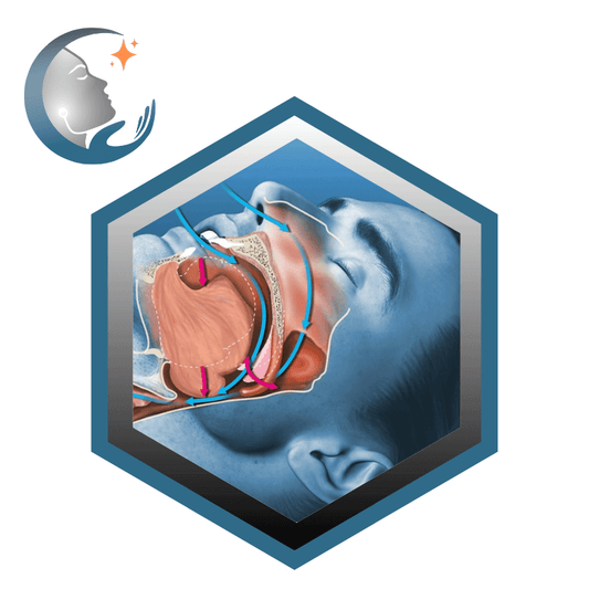 Qu’est-ce que l’Apnée du Sommeil