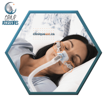 Fisher & Paykel Brevida™ Clips de courroie pour masque CPAP nasal