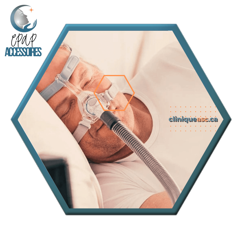 Fisher & Paykel Eson™ 2 Clips de courroies pour masque CPAP nasal